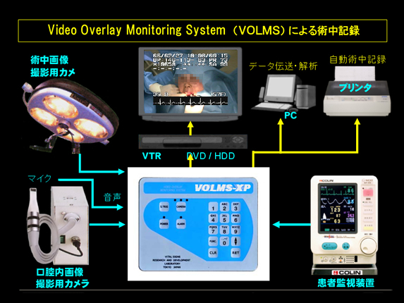 Video Overlay Monitoring System(VOLMS)による術中記録