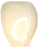 ハイブリッド・セラミックタイプ イメージ画像